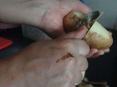 peeling potato for sun dried potato chips or aloo chips